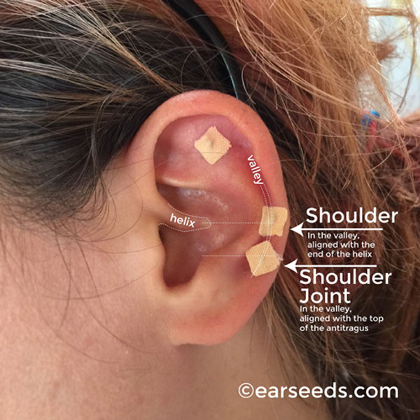 shoulder points ear seeds
