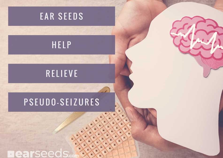 Ear Seeds Help Relieve Pseudo-Seizures