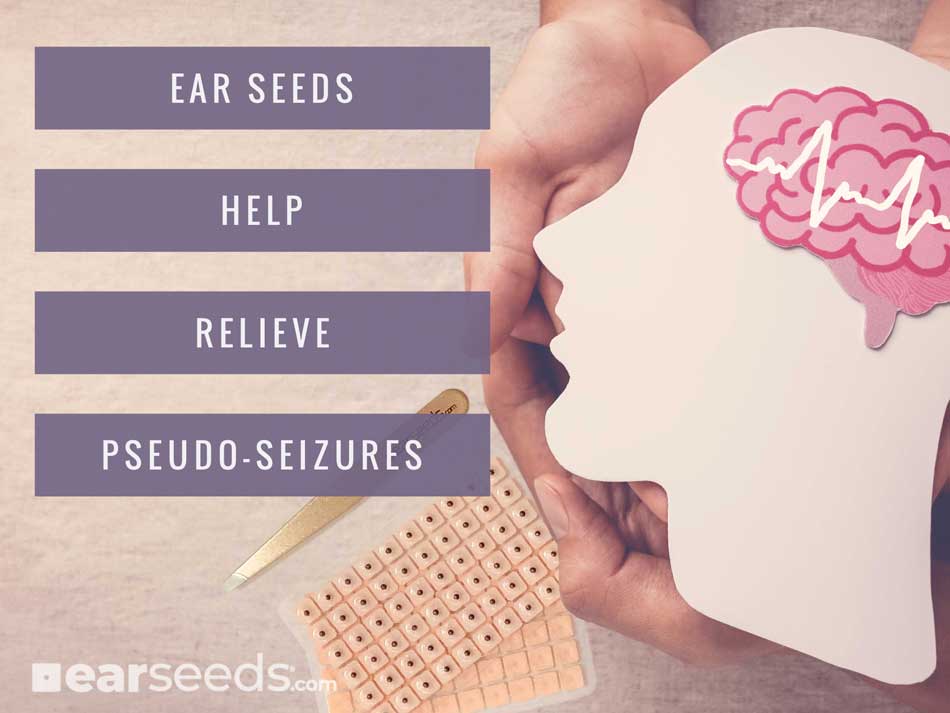EarSeeds-for-Psuedo-seizures-small