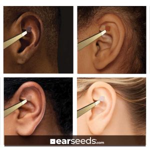 Skintoned melanated EarSeeds