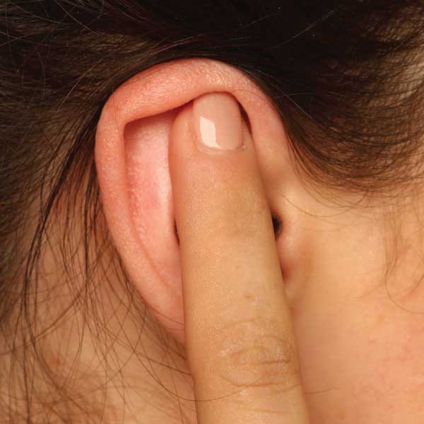 2023-Presss Ear Seeds Peel