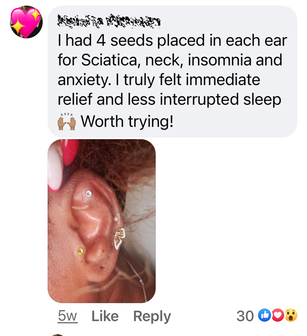 ear-seeds-testimonial-3